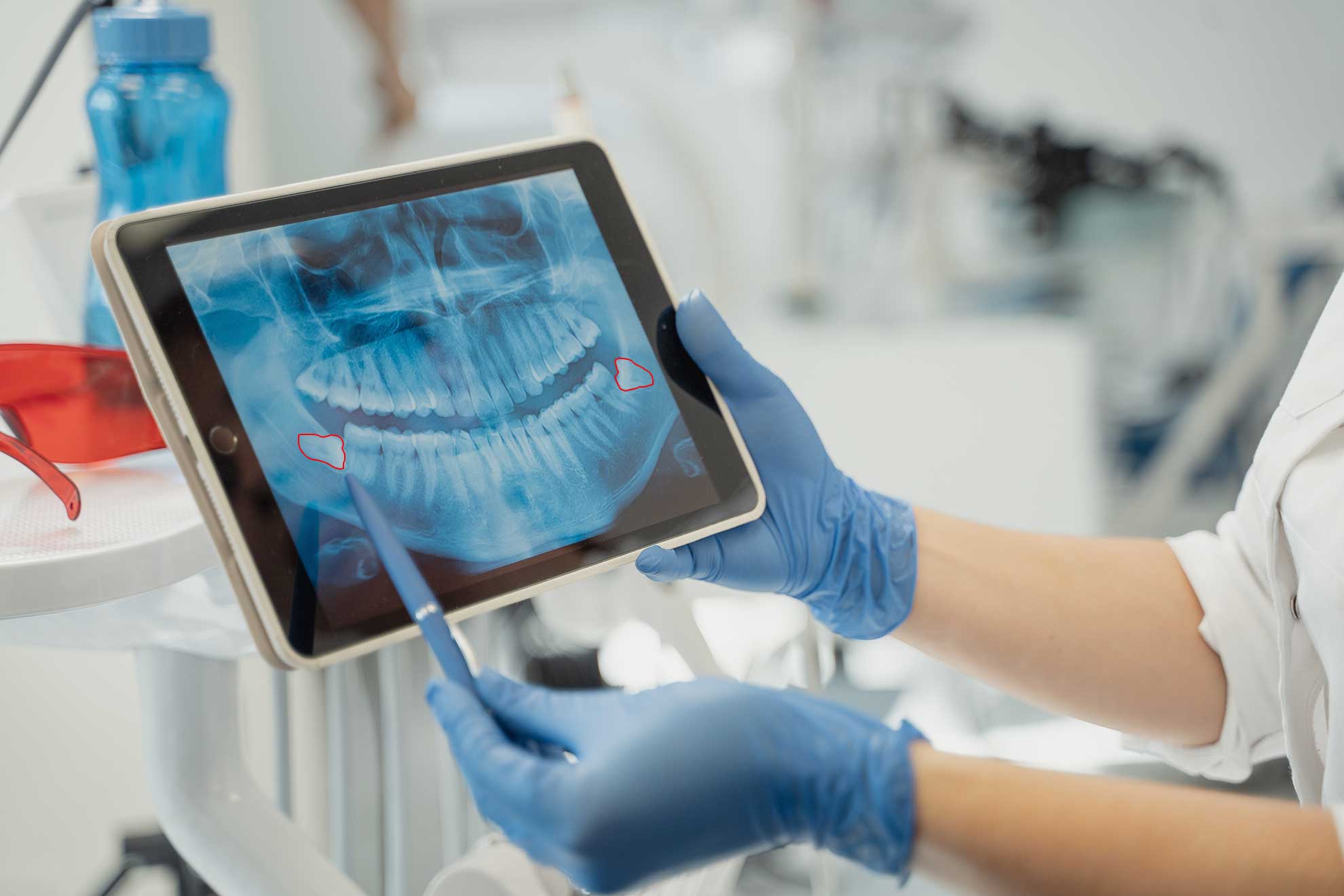 Data Annotation is Enabling the Development of Surgical AI