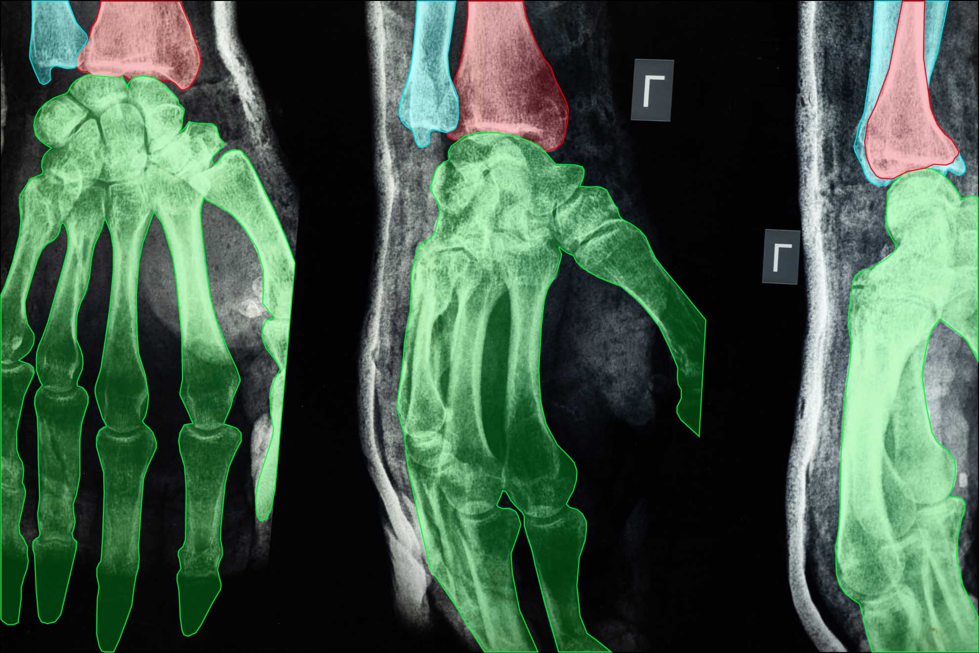 Sign Surgery Database Data Annotation Services and AI Surgery Applications|Keymakr