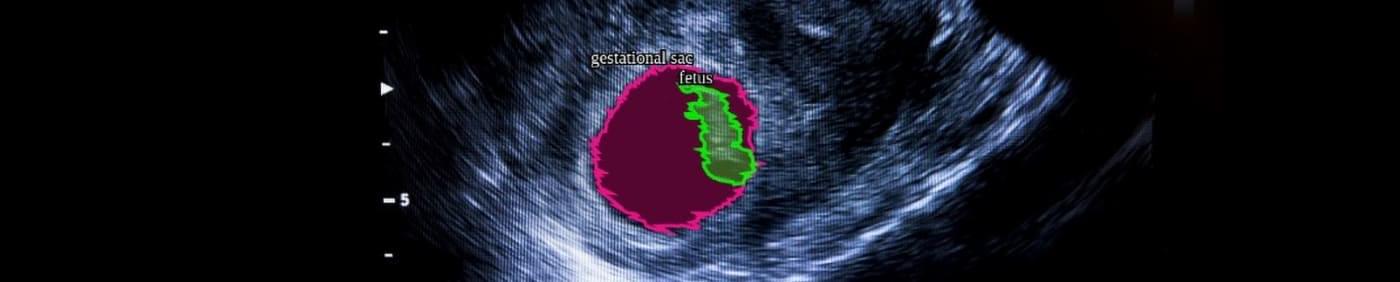 Object Classifications