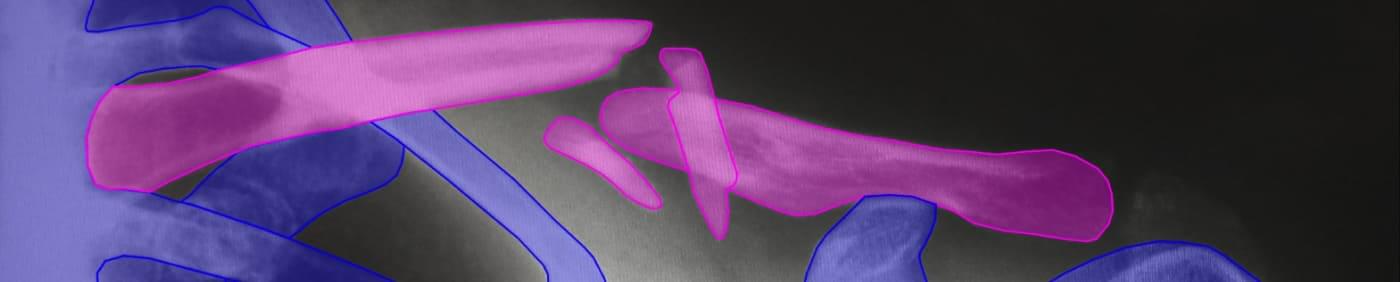 IMAGE ANNOTATION SERVICES